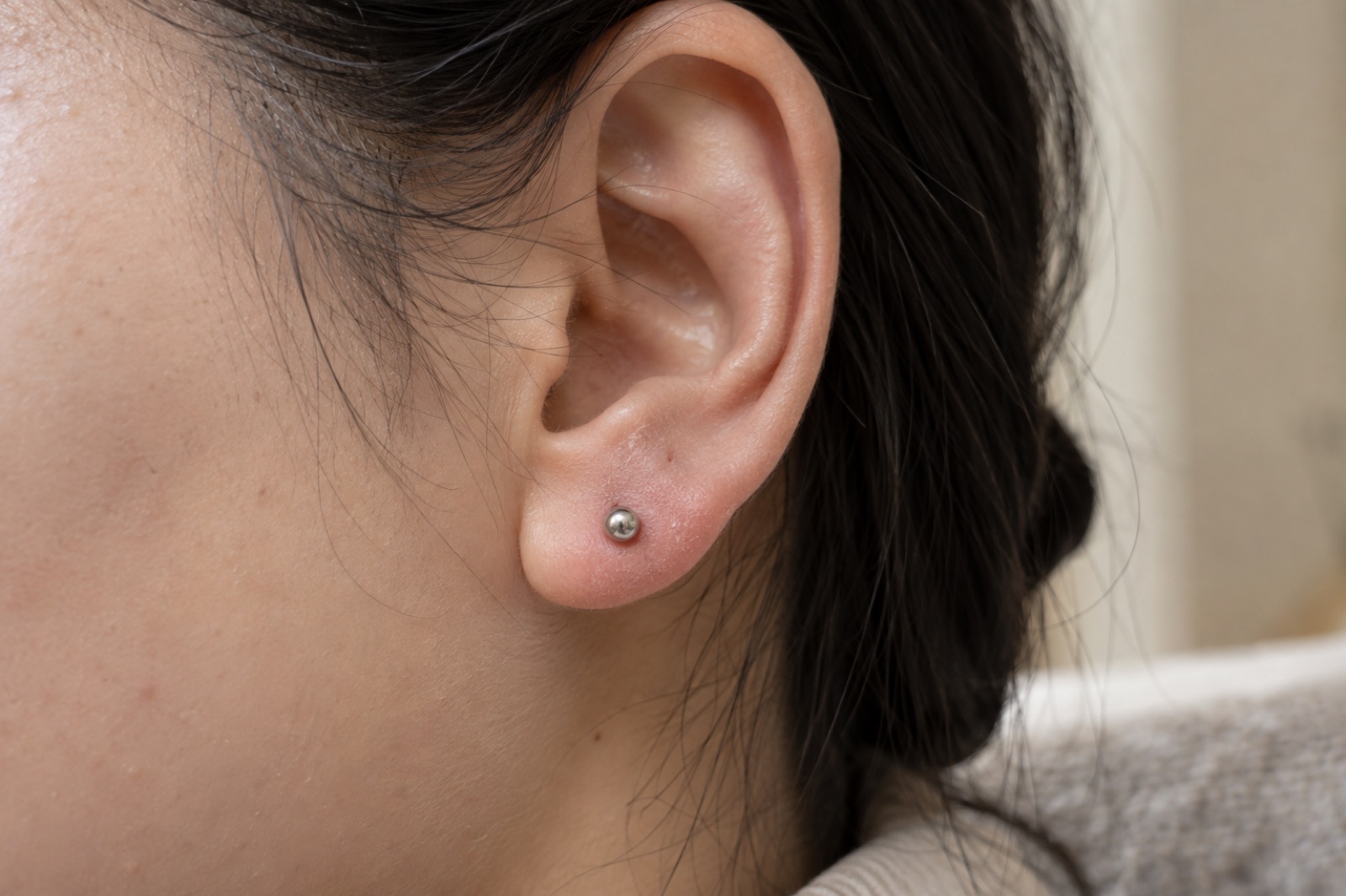 A side close-up of a woman’s ear with her hair pushed back, showing redness around a silver ball earring in her earlobe