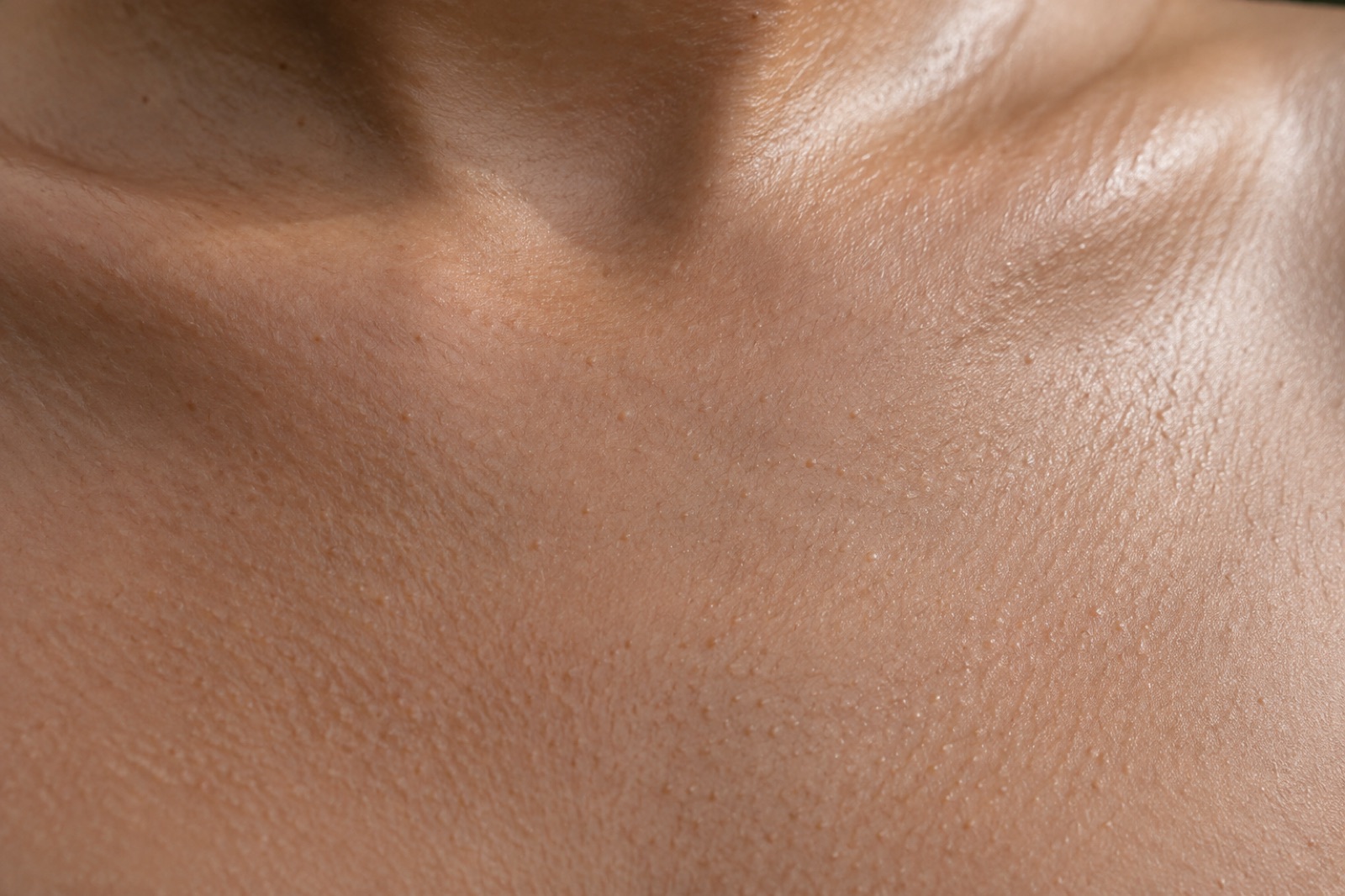 Close-up of the upper chest just below the collarbone, with small skin-colored bumps spread evenly across it