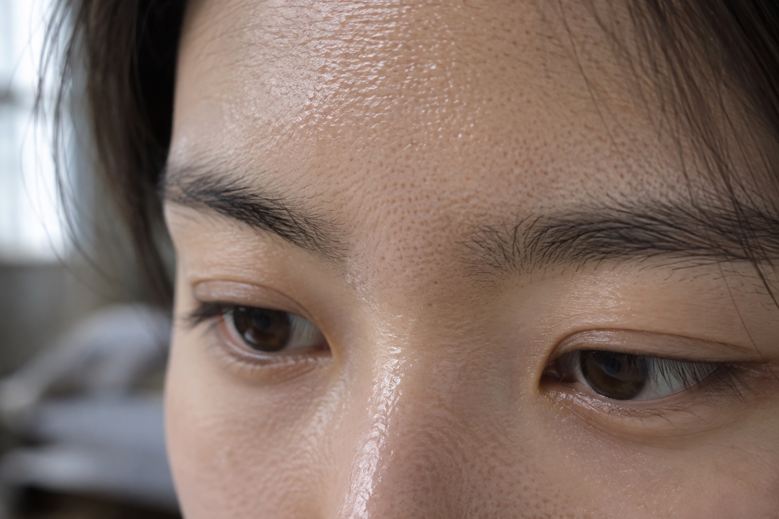 눈썹 위 이마와 미간, 콧대에 기름기가 번들거리고 모공이 촘촘히 보이는 얼굴 윗부분