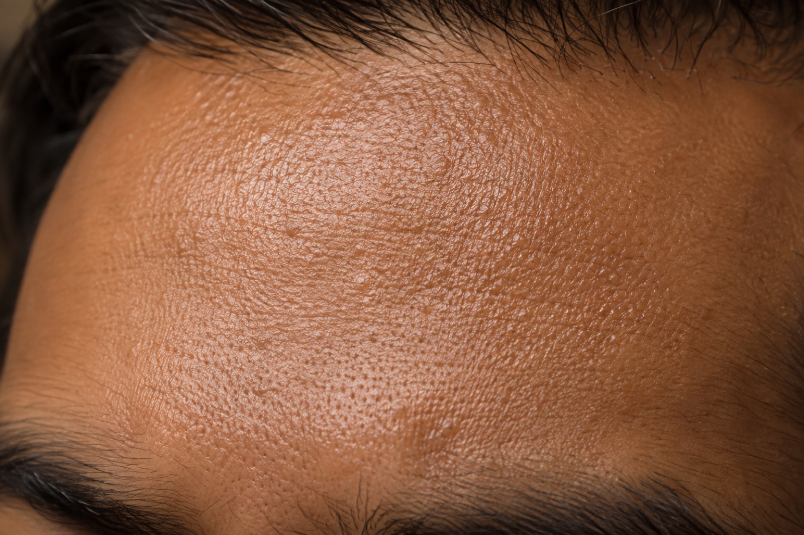 Close-up of forehead skin between dark eyebrows and hair, with fine pores and a sheen across the surface