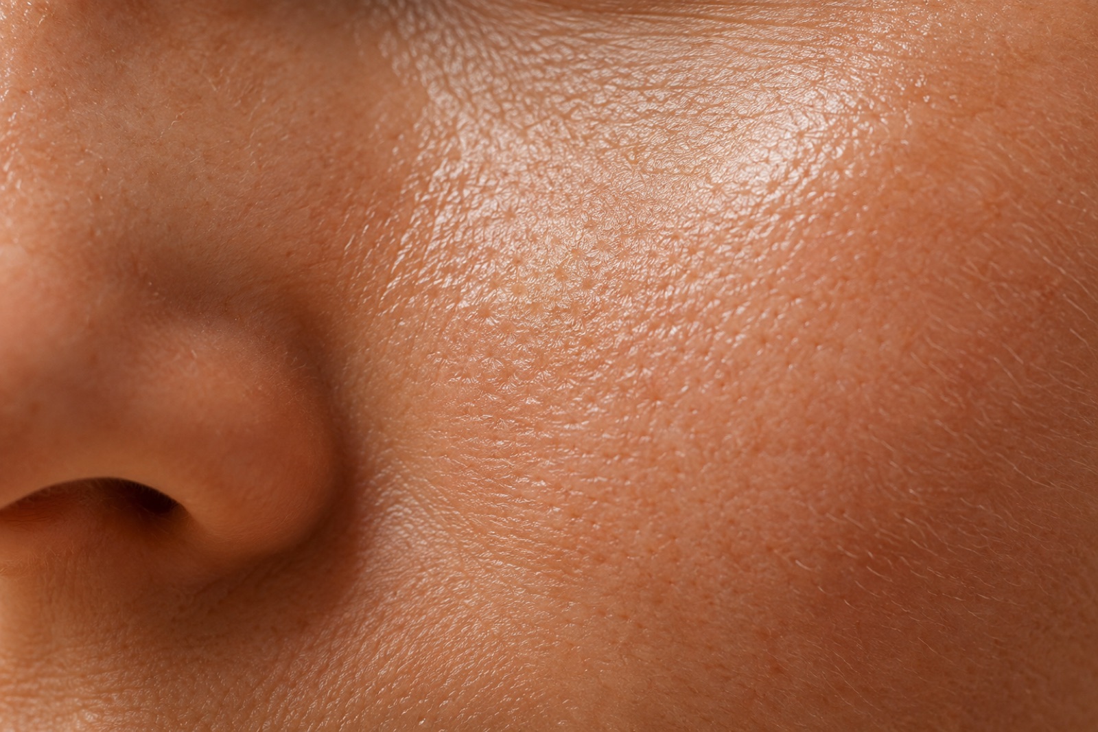 Close-up of cheek skin running from beside the nostril toward the cheekbone, showing pores and a glossy surface