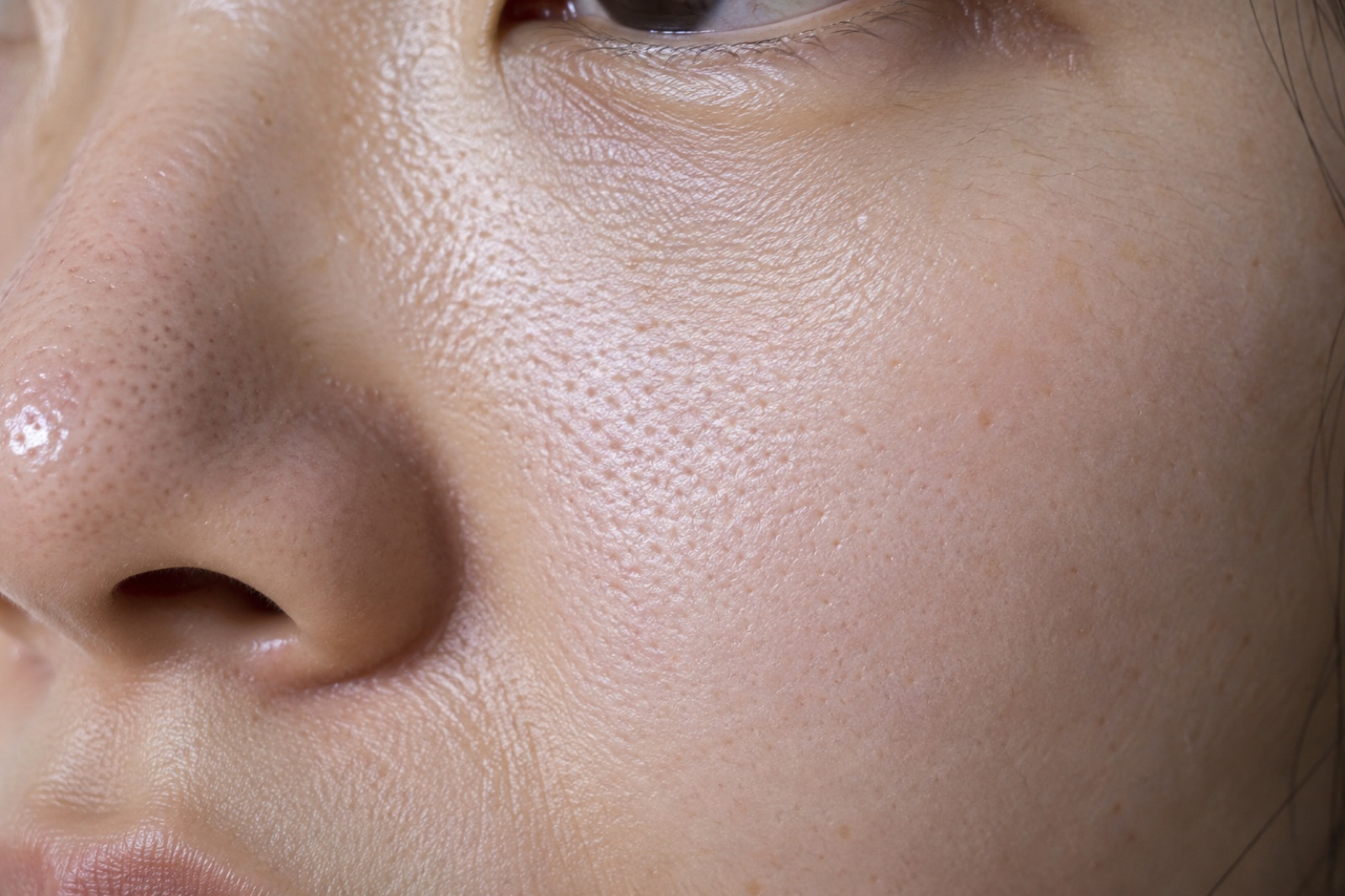 Close-up of the side of a face with visible pores on the cheek below the eye and a shine on the tip of the nose